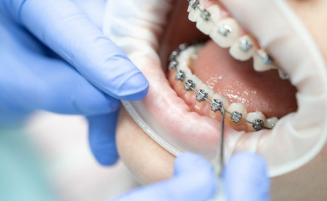 xOrthodontic treatment